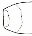regular posterior edge