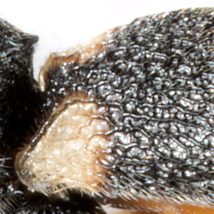 2 anterior spots