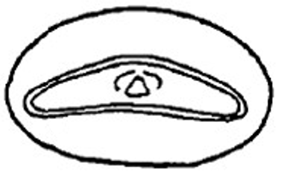 large