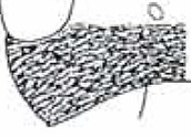 transverse rugulose