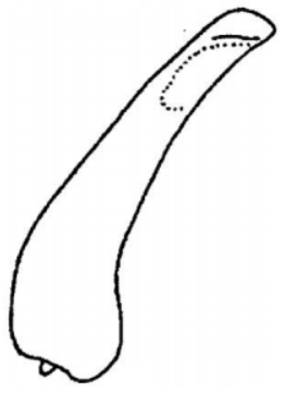 ♂ metasoma, lateral view