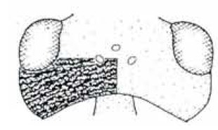 head in dorsal view with indication of its sculpture