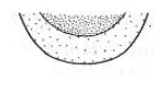 ♂ ventral apex of metasoma