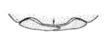 clypeus (see arrow) and pair of mandibles