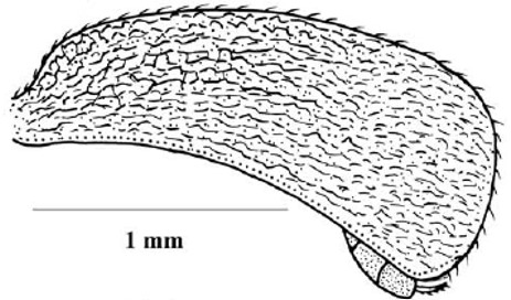metasoma, lateral view