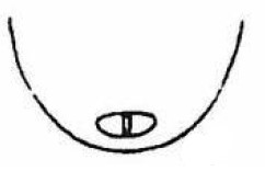 apex of metasoma of ♂ in posterior view, at an angle