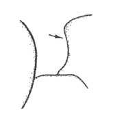 anterior part of mesonotum in lateral view