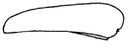 metasoma, lateral view