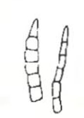 tip of antenna in anterior view (left) and in profile (right)
