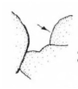 anterior part of mesonotum in lateral view (see arrow)