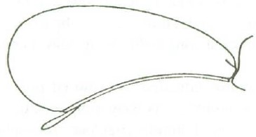 ♀ carapace in lateral view
